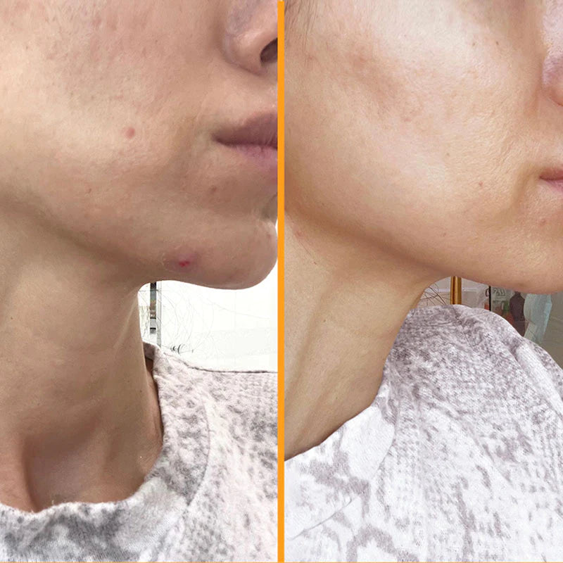 SKINtamin - Shakeproteine