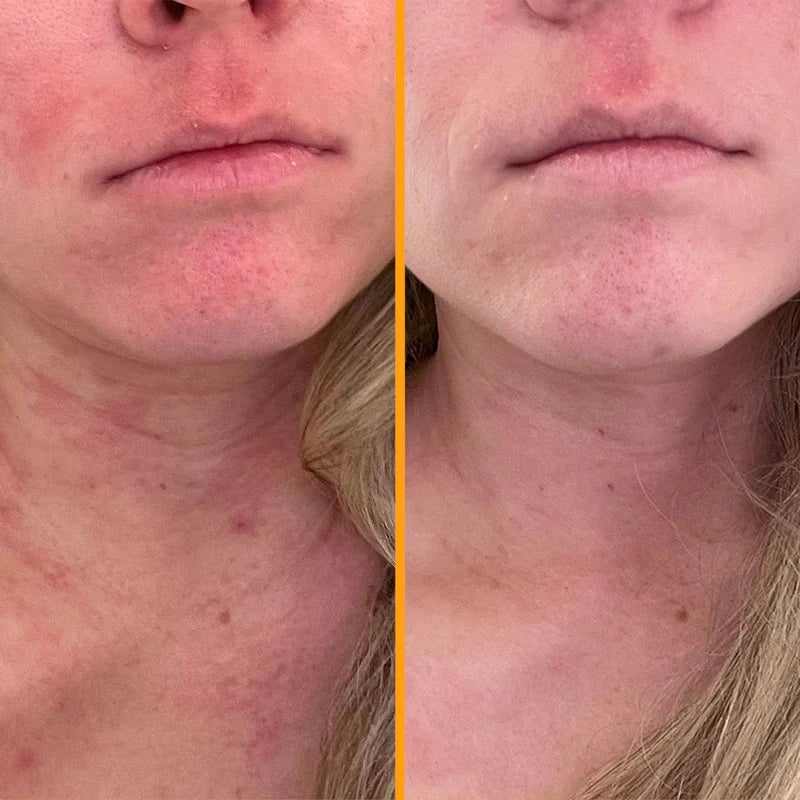 SKINtamin - Shakeproteine